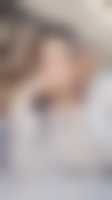 صورة العضو